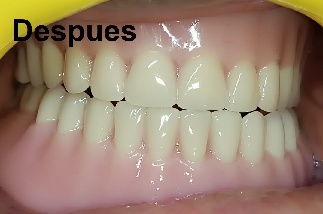 Después del tratamiento