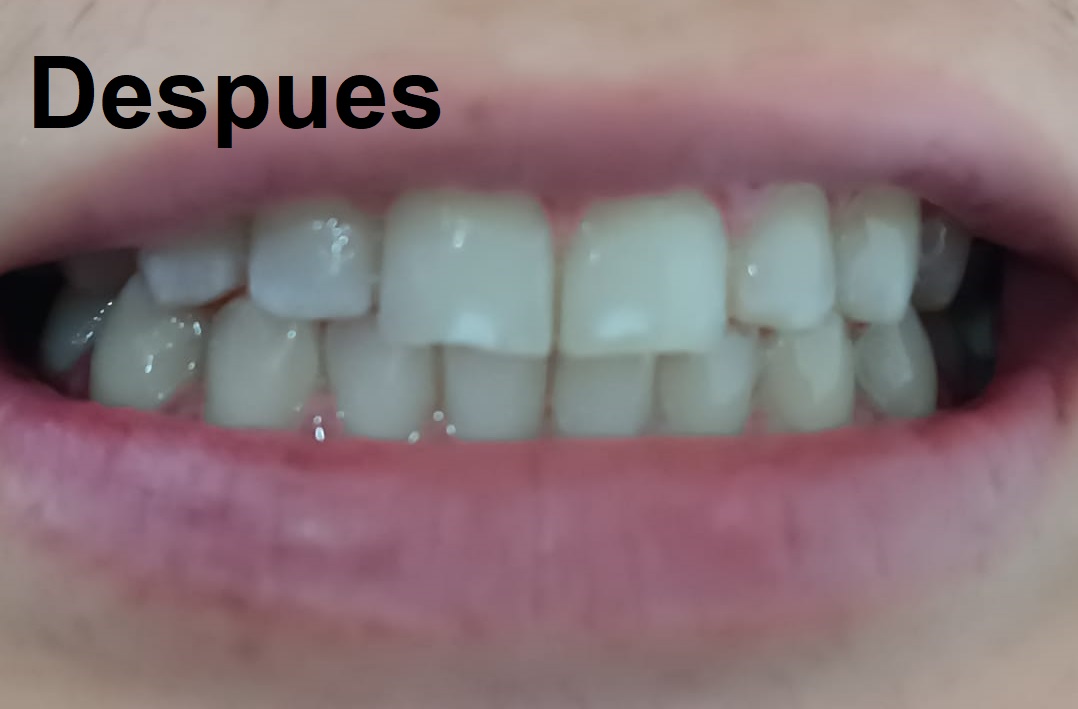 Después del tratamiento